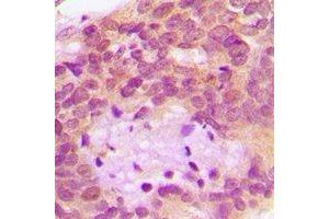 Immunohistochemistry (IHC) image for anti-serine Peptidase Inhibitor, Kunitz Type 1 (SPINT1) antibody (ABIN7308368) (SPINT1 Antikörper)