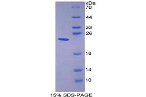 SDS-PAGE analysis of Human Gastrokine 2 Protein. (Gastrokine 2 Protein (GKN2))