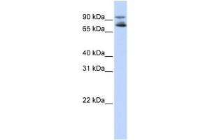 WB Suggested Anti-FOXK2 Antibody Titration:  0.