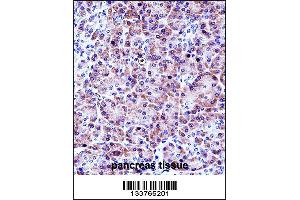 CELA3A Antibody immunohistochemistry analysis in formalin fixed and paraffin embedded human pancreas tissue followed by peroxidase conjugation of the secondary antibody and DAB staining. (Elastase 3A Antikörper  (AA 157-186))