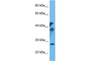 Western Blotting (WB) image for anti-Retina and Anterior Neural Fold Homeobox (RAX) (N-Term) antibody (ABIN2777501)