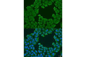 Immunofluorescence analysis of U2OS cells using STXBP3 antibody. (STXBP3 Antikörper  (AA 343-592))