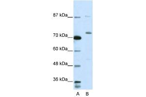 EXOSC10 antibody used at 5 ug/ml to detect target protein.
