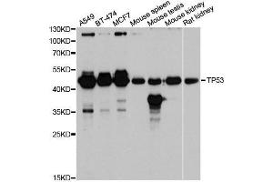 Western blot analysis of extracts of various cell lines, using TP53 antibody. (p53 Antikörper  (AA 1-100))