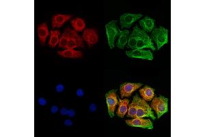 ABIN6261019 and ABIN6273216 staining Hela cells by IF/ICC. (CRAT Antikörper  (N-Term))