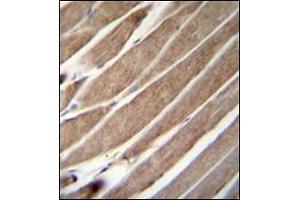 Immunohistochemistry (Paraffin-embedded Sections) (IHC (p)) image for anti-Autophagy related 4D Cysteine Peptidase (ATG4D) (AA 49-79), (N-Term) antibody (ABIN1449592)