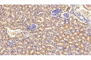 Detection of C3 Convertase in Mouse Kidney Tissue using Polyclonal Antibody to Complement C3 Convertase (C3 Convertase) (Complement C3 Convertase Antikörper)