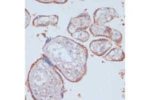 Immunohistochemistry (IHC) image for anti-Low Density Lipoprotein Receptor-Related Protein 1 (LRP1) (AA 20-270) antibody (ABIN3021969)