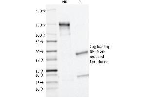 SDS-PAGE Analysis Purified MRP1/ABCC1 Monoclonal Antibody (MRP1/1343).