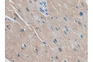 DAB staining on IHC-P; Samples: Rat Heart Tissue (RSPO1 Antikörper  (AA 21-135))