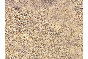 LAG3/CD223 Mouse Monoclonal Antibody at 1/100 staining rat spleen tissue by IHC-P.
