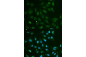 Immunofluorescence analysis of MCF7 cell using ABO antibody. (ABO Antikörper  (AA 54-354))