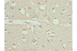 Immunohistochemistry of paraffin-embedded human brain tissue using ABIN7146563 at dilution of 1:100 (Calreticulin Antikörper  (AA 18-415))