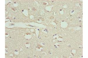 Immunohistochemistry (IHC) image for anti-Calreticulin (CALR) (AA 18-415) antibody (ABIN7146563)