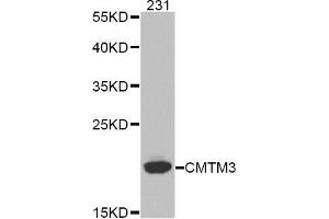 Western blot analysis of extracts of 231 cell line, using CMTM3 antibody. (CMTM3 Antikörper)