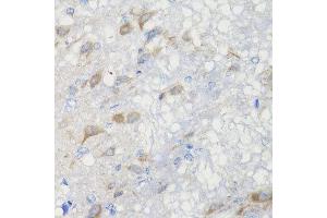 Immunohistochemistry of paraffin-embedded rat brain using CHIC2 antibody at dilution of 1:100 (x40 lens).