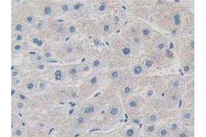 IHC-P analysis of Human Liver Tissue, with DAB staining. (GRK4 Antikörper  (AA 187-449))