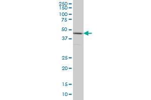 HNRNPG-T monoclonal antibody (M01), clone 6F11 Western Blot analysis of HNRNPG-T expression in HeLa . (RBMXL2 Antikörper  (AA 1-90))