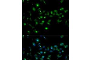 Immunofluorescence analysis of MCF7 cells using MORF4L1 Polyclonal Antibody (MORF4L1 Antikörper)