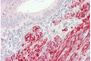 Human Uterus: Formalin-Fixed, Paraffin-Embedded (FFPE) (INPP5K Antikörper  (AA 183-430))