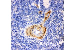 Immunohistochemistry (IHC) image for anti-Gelsolin (GSN) (AA 580-782) antibody (ABIN3042436)