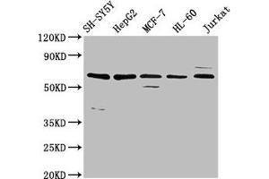 Western Blot Positive WB detected in: SH-SY5Y whole cell lysate, HepG2 whole cell lysate, MCF-7 whole cell lysate, HL-60 whole cell lysate, Jurkat whole cell lysate All lanes: HRG antibody at 4. (HRG Antikörper  (AA 412-511))