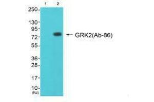 Western blot analysis of extracts from cos-7 cells (Lane 2), using GRK2 (Ab-86) antiobdy. (GRK2 Antikörper  (N-Term))