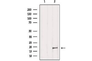 Western blot analysis of extracts from B16F10, using MAX Antibody. (MAX Antikörper  (N-Term))