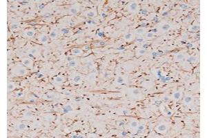 ABIN6272737 at 1/200 staining Rat brain tissue sections by IHC-P. (P2RY12 Antikörper  (N-Term))