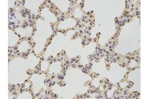 Immunohistochemistry (IHC) image for anti-thromboxane A Synthase 1 (Platelet) (TBXAS1) antibody (ABIN1875427) (TBXAS1 Antikörper)