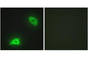 Immunofluorescence analysis of HeLa cells, using DUSP6 Antibody. (DUSP6 Antikörper  (AA 61-110))