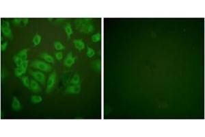 Immunofluorescence analysis of A549 cells, using Stefin A Antibody . (CSTA Antikörper  (Internal Region))