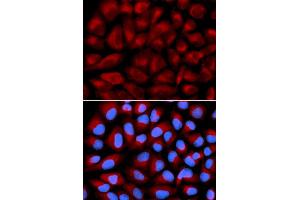 Immunofluorescence analysis of U2OS cell using FANCC antibody.