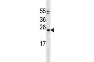 Western Blotting (WB) image for anti-GTPase Kras (KRAS) (AA 146-174) antibody (ABIN3031120)