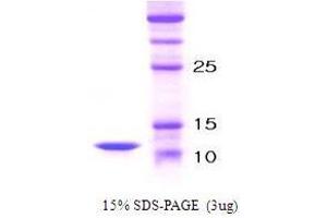Figure annotation denotes ug of protein loaded and % gel used. (PTH Protein)