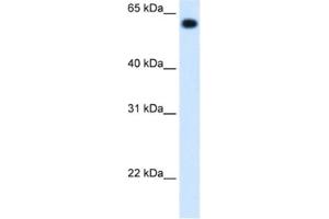 Western Blotting (WB) image for anti-Aldehyde Dehydrogenase 4 Family, Member A1 (ALDH4A1) antibody (ABIN2462884) (ALDH4A1 Antikörper)