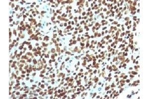 IHC testing of FFPE human tonsil with Nuclear Antigen antibody. (Nuclear Antigen Antikörper)