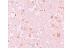 Immunohistochemical staining of human brain cells with NLRP7 polyclonal antibody  at 10 ug/mL. (NLRP7 Antikörper  (N-Term))