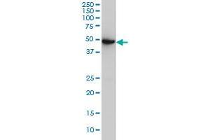 ASB10 monoclonal antibody (M02), clone 1F3 Western Blot analysis of ASB10 expression in A-431 . (ASB10 Antikörper  (AA 48-153))