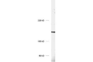 dilution: 1 : 1000, sample: rat hippocampus homogenate (UBE3B Antikörper)