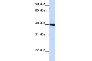 WB Suggested Anti-CEBPB Antibody Titration: 0. (CEBPB Antikörper  (N-Term))
