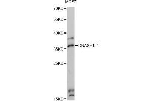 Western blot analysis of extracts of MCF7 cells, using DNASE1L1 Antibody (ABIN6292460) at 1:3000 dilution. (DNASEX Antikörper)