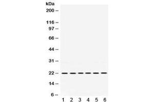 Western blot testing of 1) rat spleen, 2) rat stomach, 3) rat intestine, 4) human MCF7, 5) human A549 and 6) human SKOV lysate with BIK antibody. (BIK Antikörper  (AA 1-123))