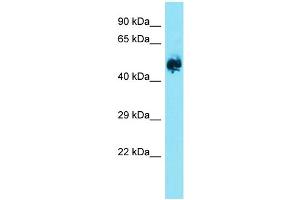Western Blotting (WB) image for anti-Eukaryotic Translation Initiation Factor 2B, Subunit 3 Gamma, 58kDa (EIF2B3) (Middle Region) antibody (ABIN2790399)