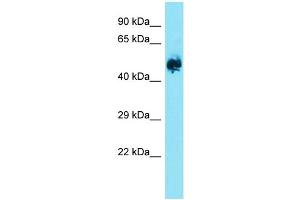 Host: Rabbit  Target Name: Eif2b3  Sample Tissue: Rat Brain lysates  Antibody Dilution: 1. (EIF2B3 Antikörper  (Middle Region))