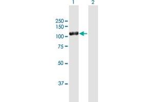 Western Blot analysis of DPP4 expression in transfected 293T cell line by DPP4 MaxPab polyclonal antibody. (DPP4 Antikörper  (AA 1-766))
