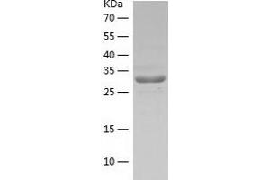 Ribokinase Protein (RBKS) (AA 1-322) (His tag)