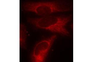 Immunofluorescence staining of methanol-fixed HeLa cells using Phospho-YWHAZ-S58 antibody (ABIN2987575). (14-3-3 zeta Antikörper  (pSer58))