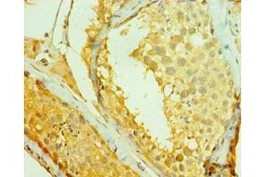 Immunohistochemistry of paraffin-embedded human testis tissue using ABIN7147263 at dilution of 1:100 (RAD1 Antikörper  (AA 1-282))