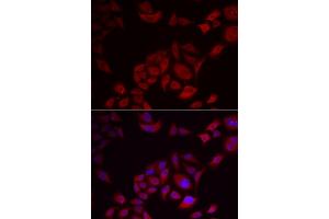 Immunofluorescence analysis of U2OS cells using PIKFYVE antibody (ABIN5974035). (PIKFYVE Antikörper)